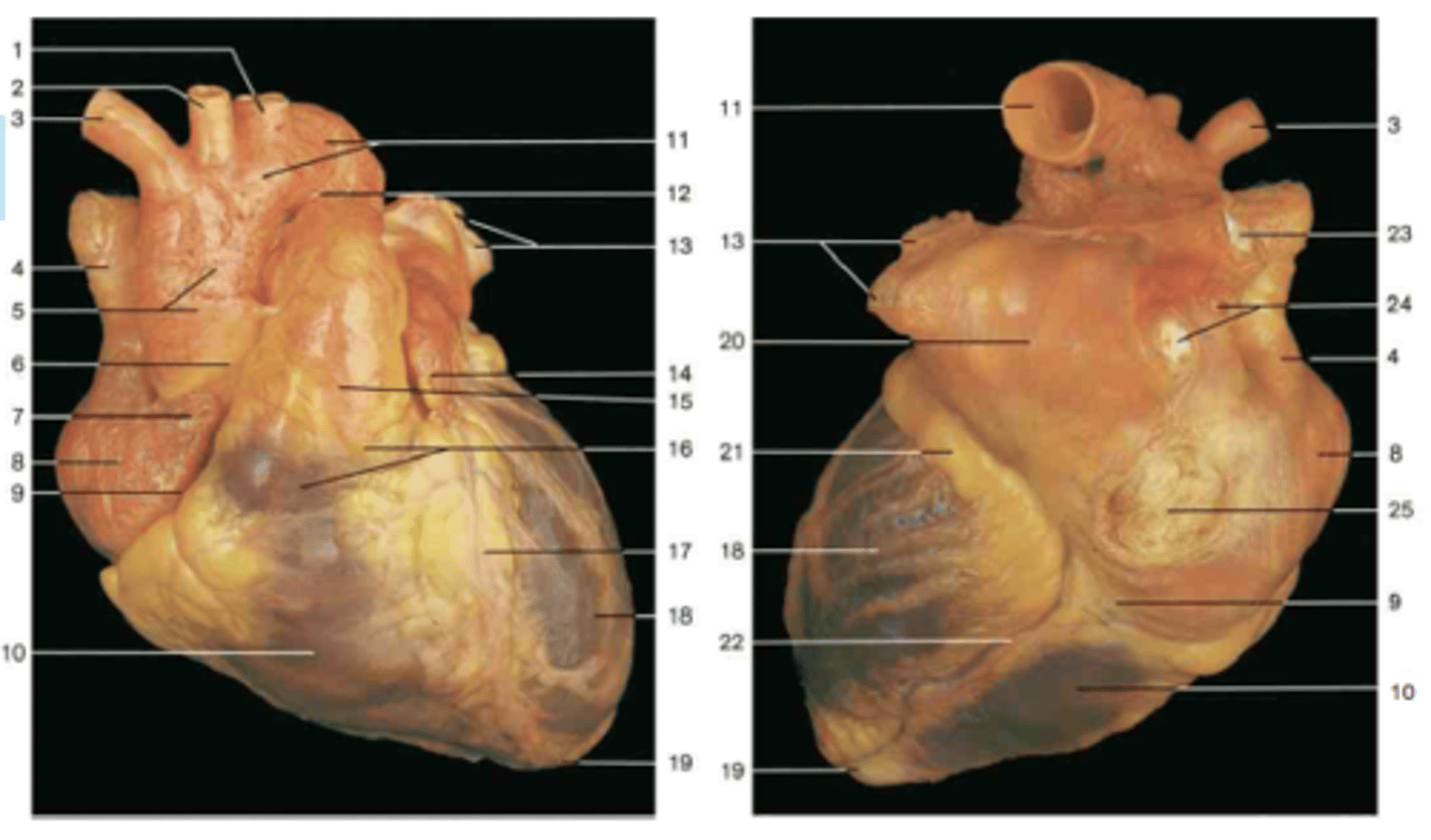 <p>Description: Groove separating the atria from the ventricles</p><p>Relationship: Contains the right and left coronary arteries, circumflex artery, and coronary sinus</p>