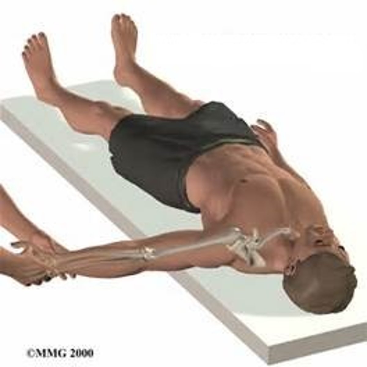 <p>done with the patient's limb numbed and orthopedist manipulates the bones to get them back into place</p>