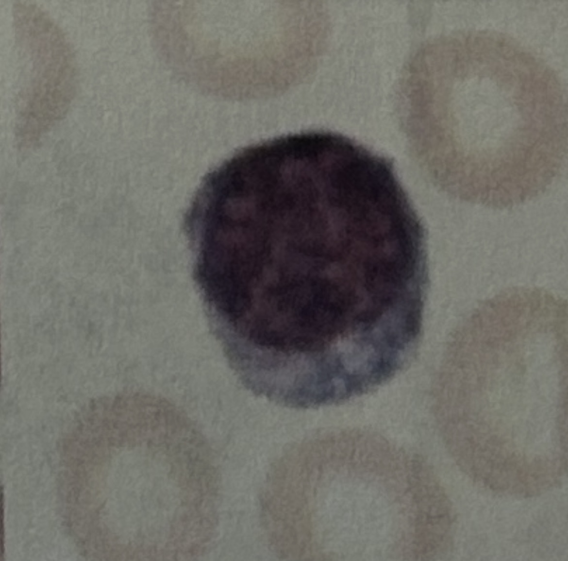 <p>WBC</p>