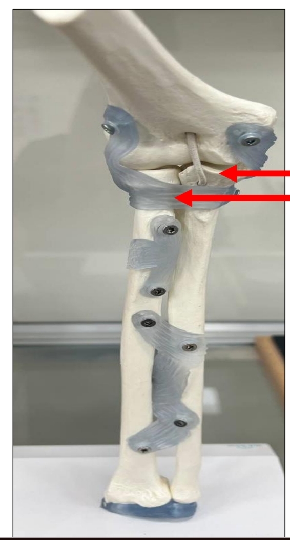 <p>identify the 2 joints respectively</p><p>mention the type of the upper joint according to number of bones </p><p>mention their type according to  the shape of articulating bones</p>