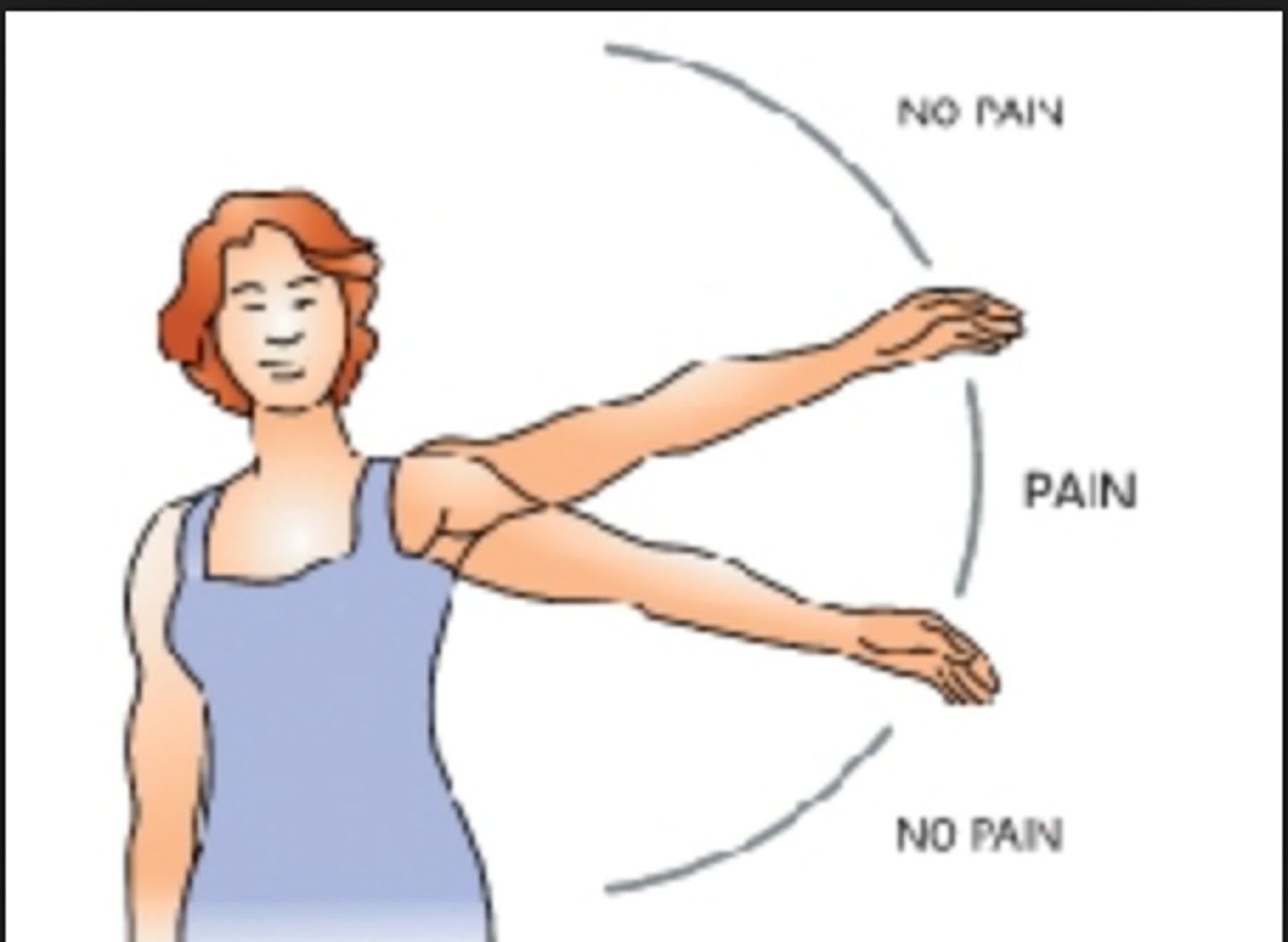 <p>painful arch test</p>