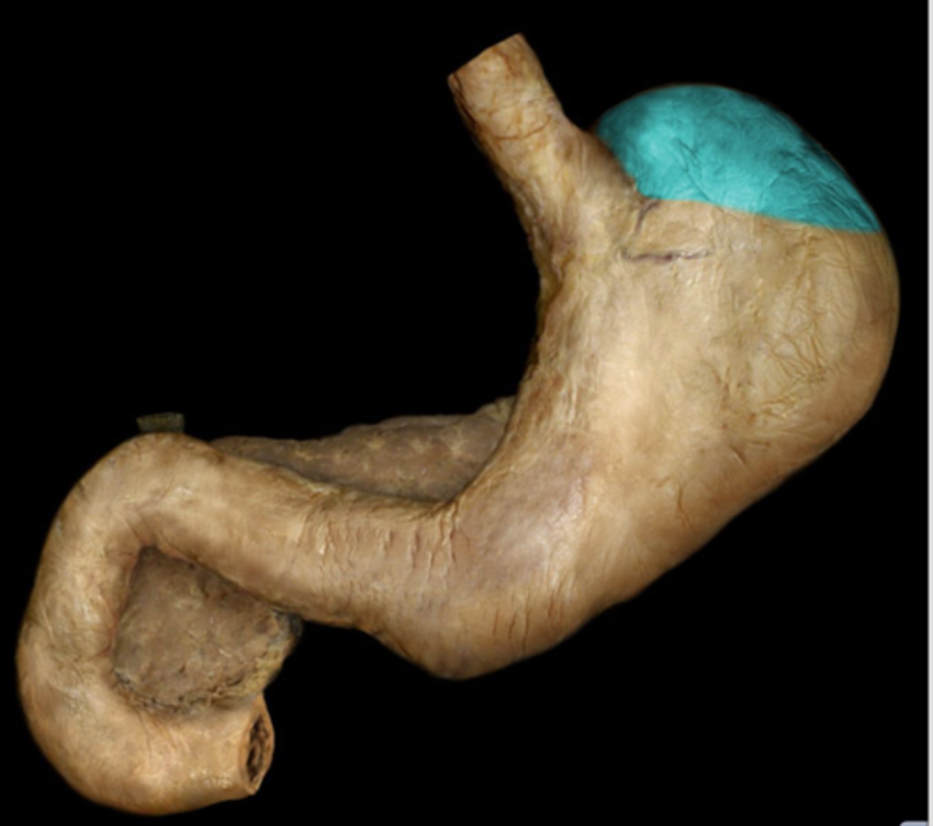 <p>balloons out toward left side</p>