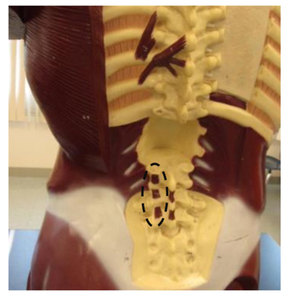 <p>model near sink (found on the transverse processes of the vertebrates)</p>