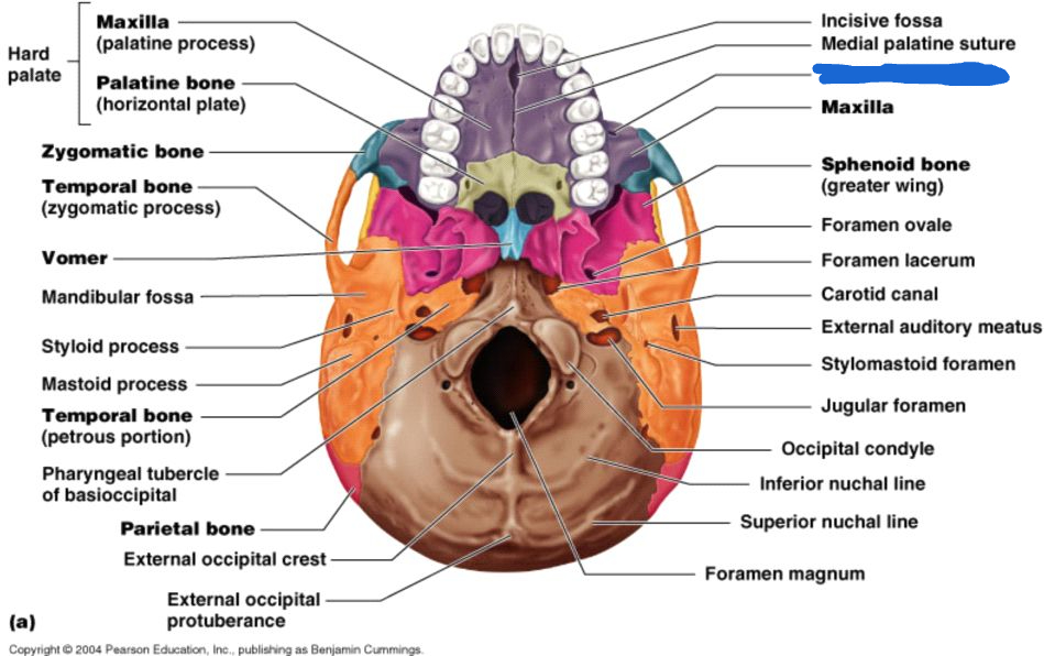 <p>infraorbital foramen (inferior view)</p>