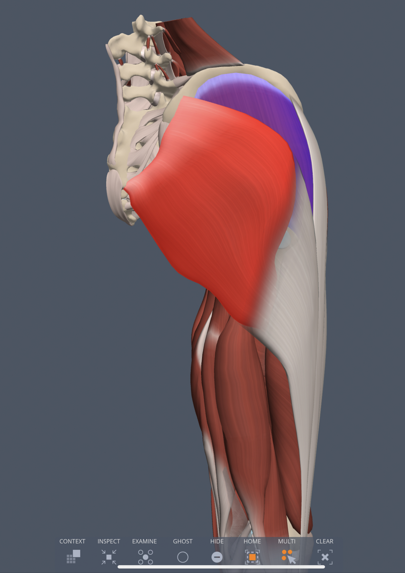 gluteus medius insertion
