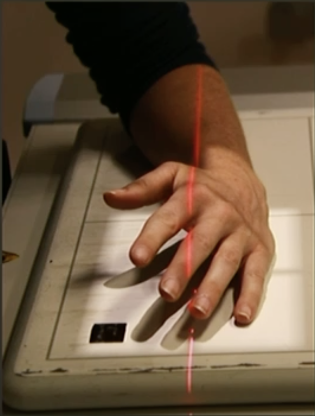 <p>Fine FS, 100cm</p><p>52kVp/2mAs</p><p>Straight tube</p><p>CR: 3rd metacarpophalangeal joint</p>