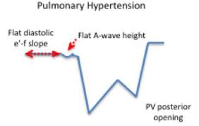 <p>Flying w sign</p>