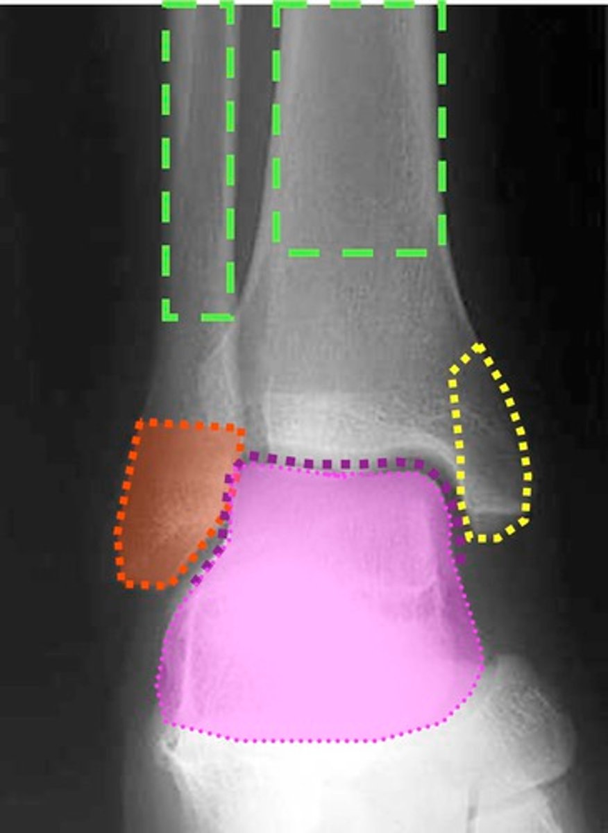 <p>The tibia and fibula</p>