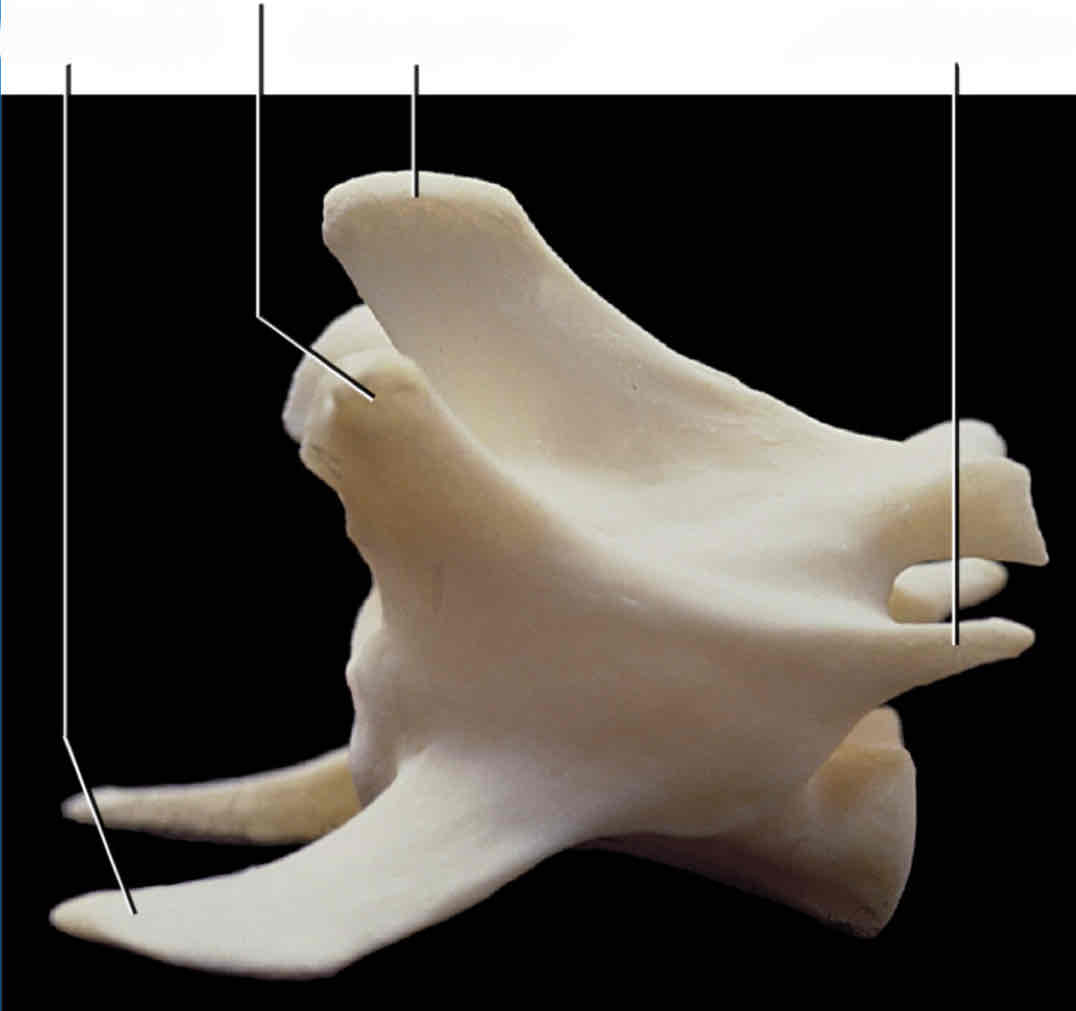 <p>What type of vertebra is this? How can you tell?</p>