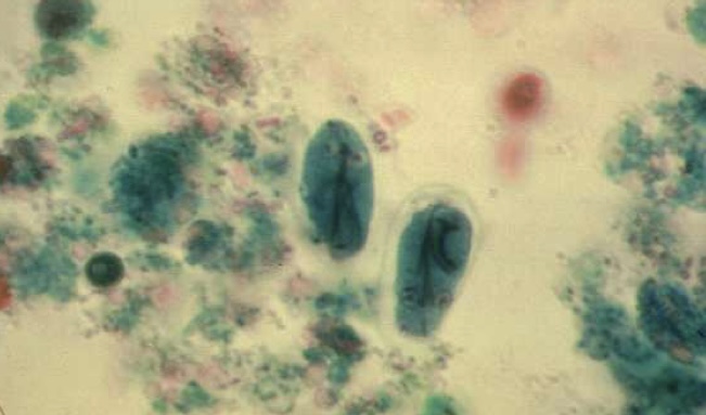 <p>Identify: Protozoa</p>