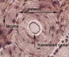 <p>matrix is dense and contains calcium, salts and collagen</p>