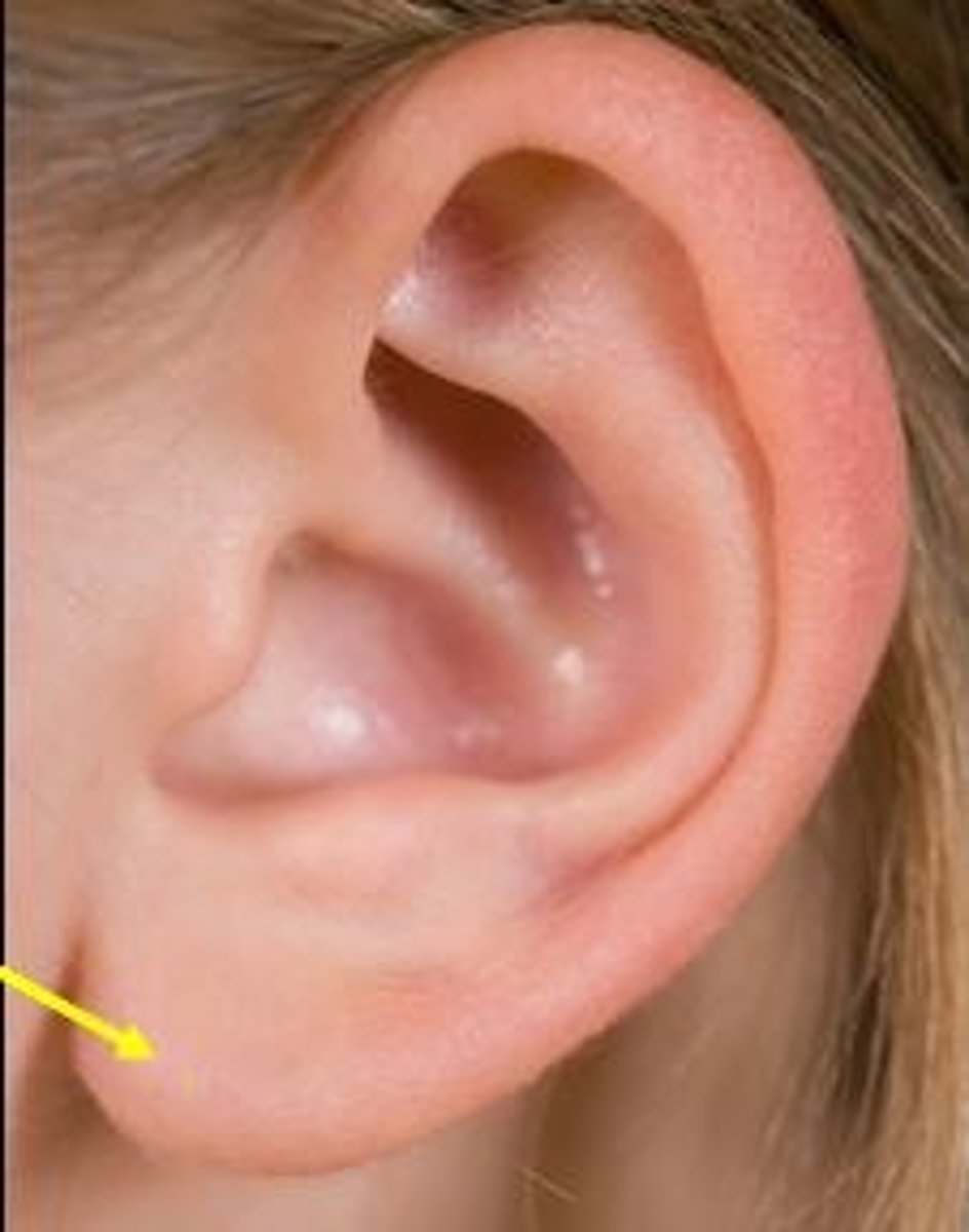 <p>consists mostly of fat cells</p>