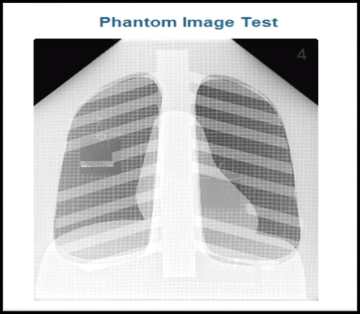 <p>Found within this Phantom Image test of a chest x-ray are test tools that can also evaluate and measure _____ and _____ </p>