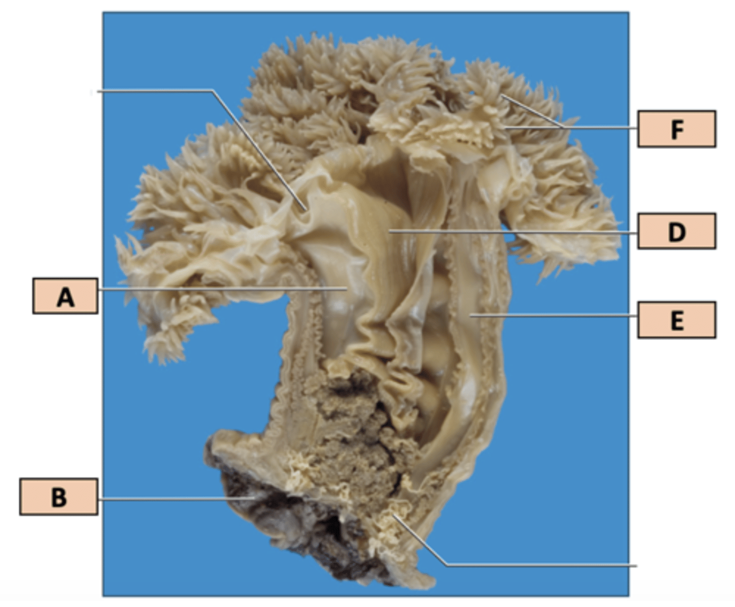 <p>1. A, E</p><p>2. F</p><p>3. B</p><p>4. Pharynx</p><p>5. Septa</p>