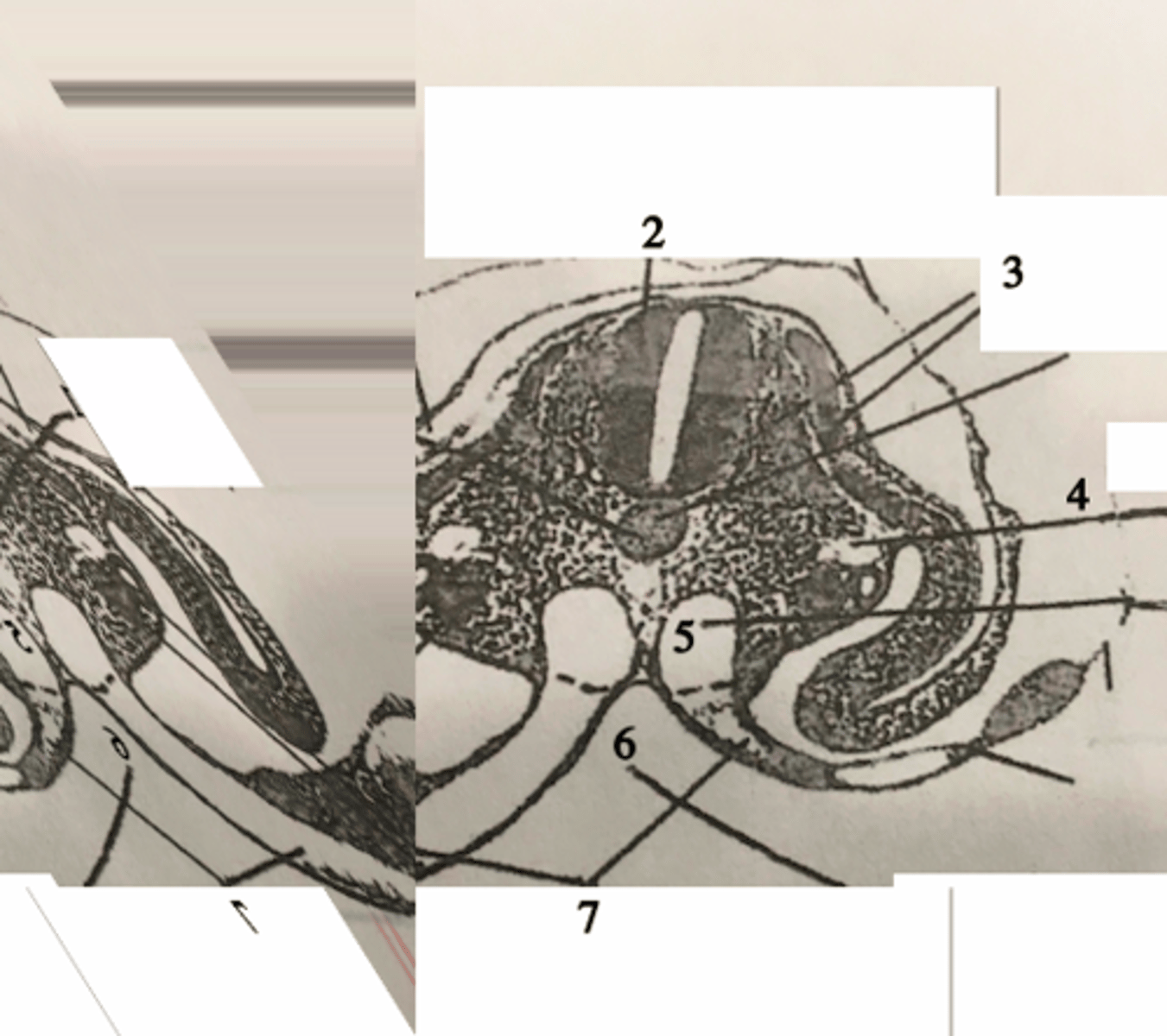 <p>#5</p>