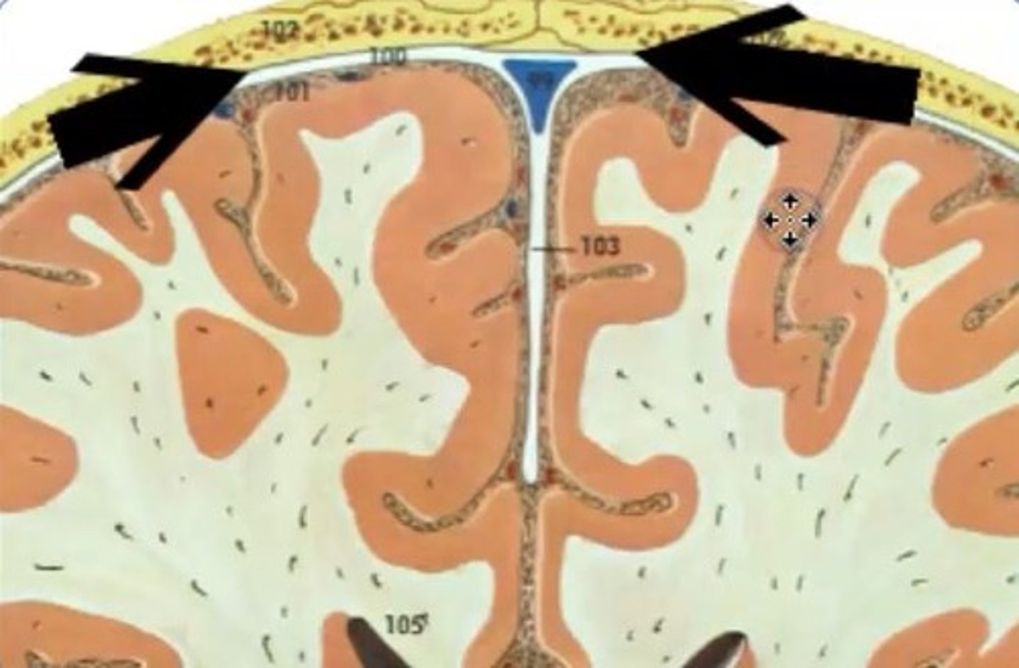 <p>ABOVE THE DURA MATER</p><p>houses meningeal arteries, branches of the external carotid artery (which supplies the dura)</p>