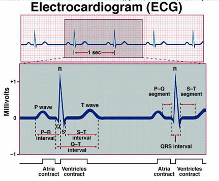 <p>ECG and the hexaxial reference system, picture attached </p>