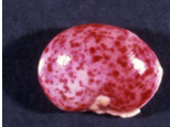 <p>Red foci </p><p>#erythrocytes caused by trauma, coagulopathies</p>