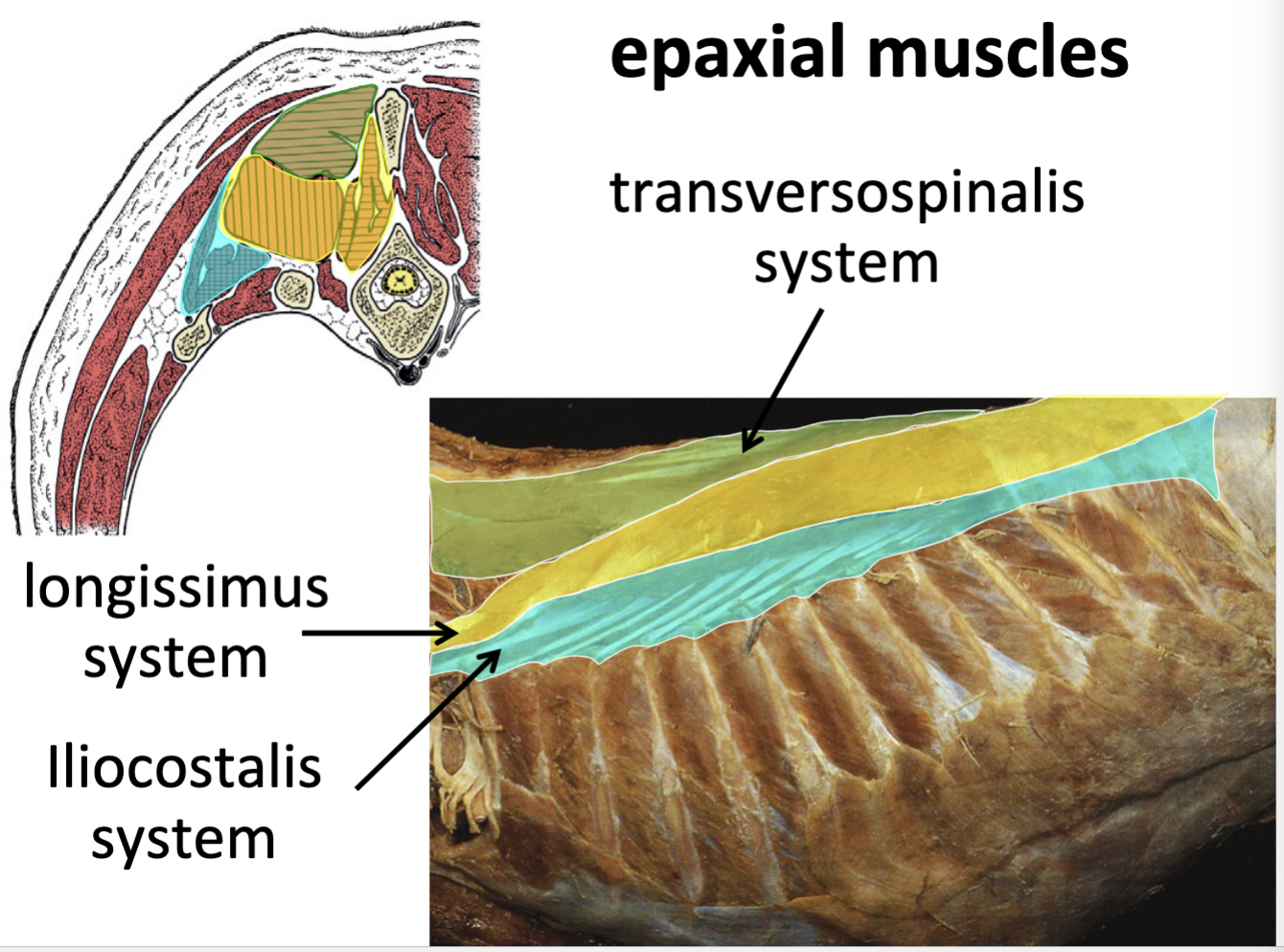 <p>Epaxial muscle systems</p>