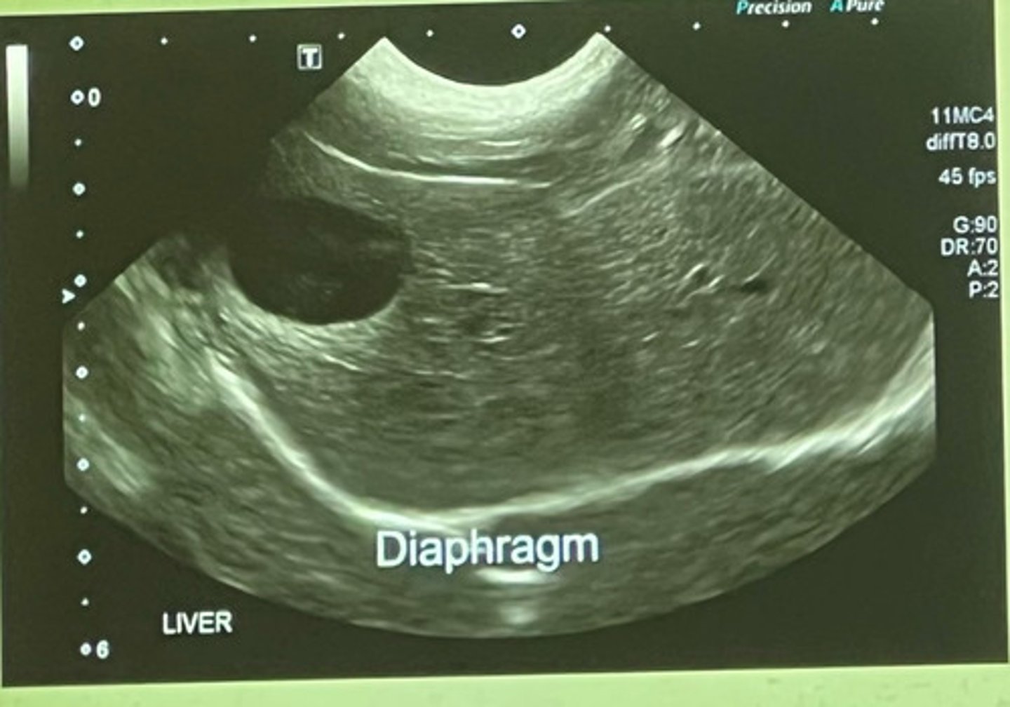 <p>what part of the liver is this showing?</p>