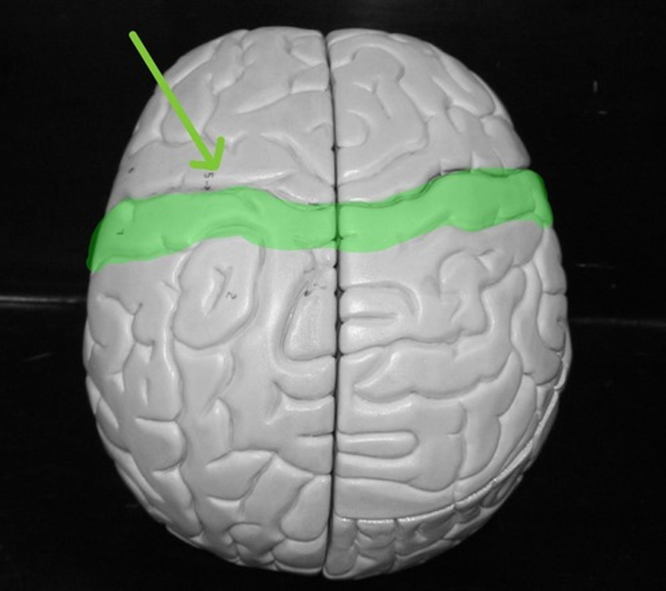 <p>Contains the primary SENSORY cortex</p>