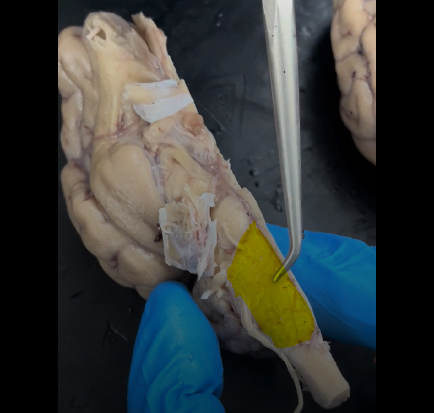 <p>Name the part of the brain highlighted in yellow.</p>