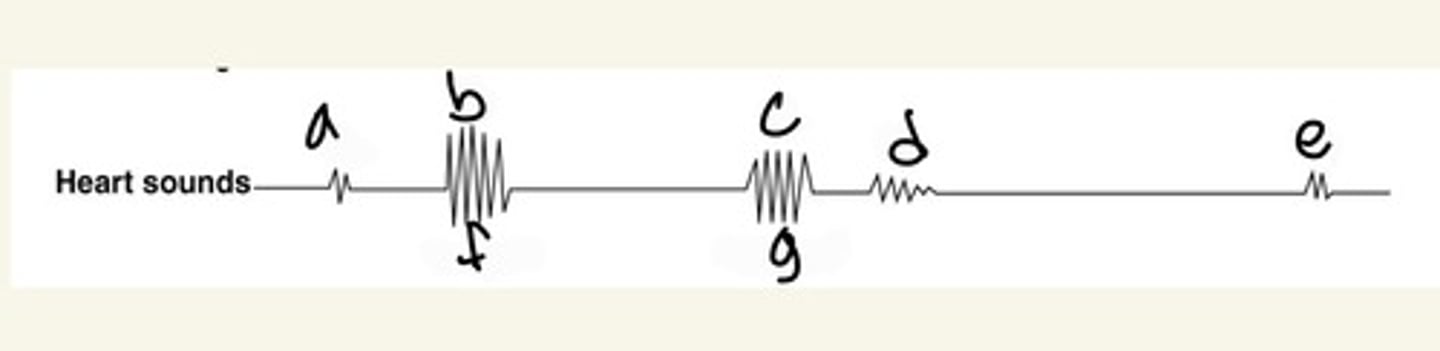 <p>closure of the aortic and pulmonary valves at the end of systole</p>