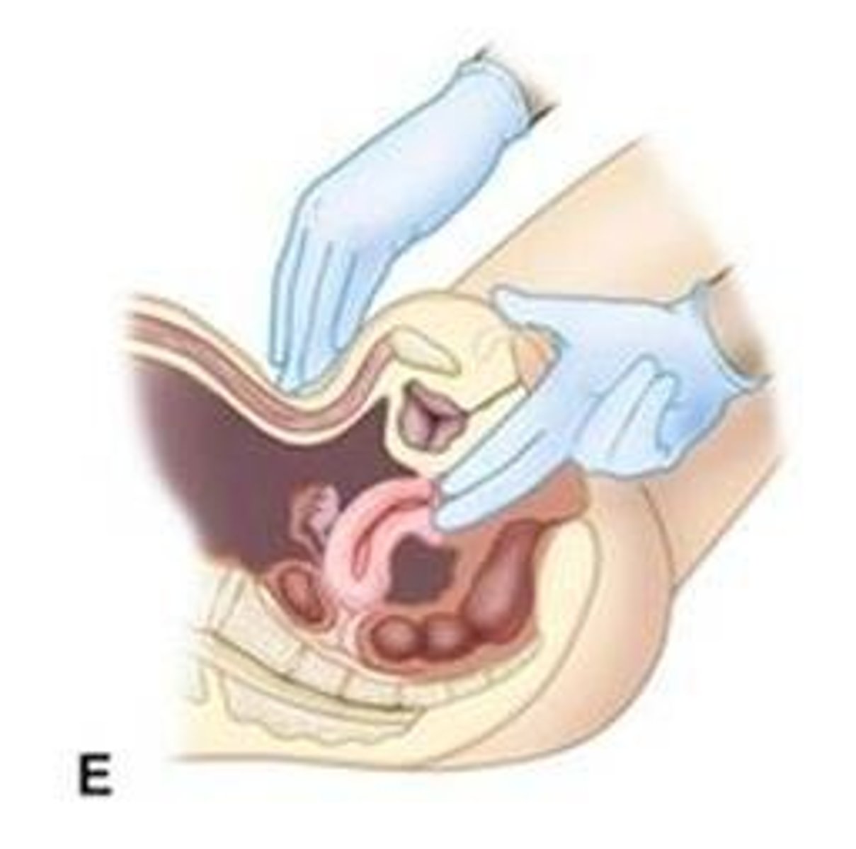 <p>If you touched the perineum or anal skin while examining the external genitalia, change gloves before beginning internal examination.</p>