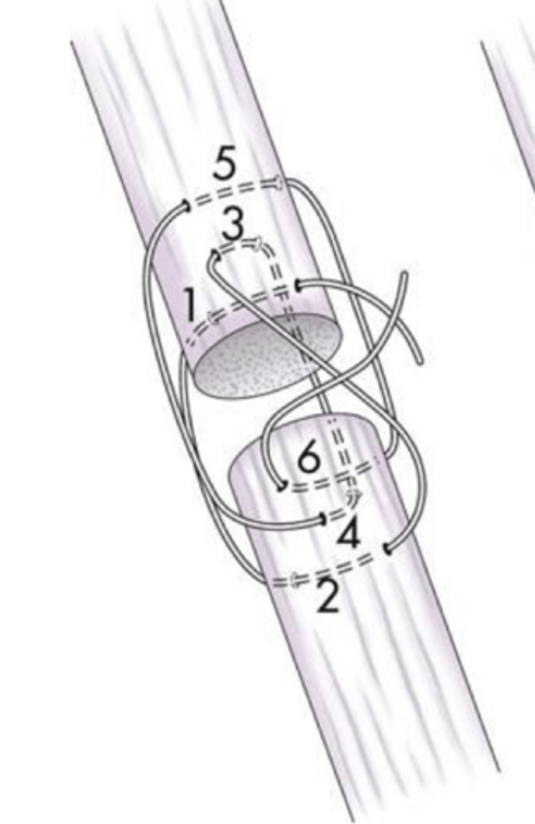 <p>what ligament/tendon suture pattern is shown here that is ideal for round tendon/ligaments</p>