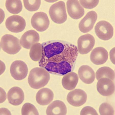 <p>What is this leukocyte?</p>