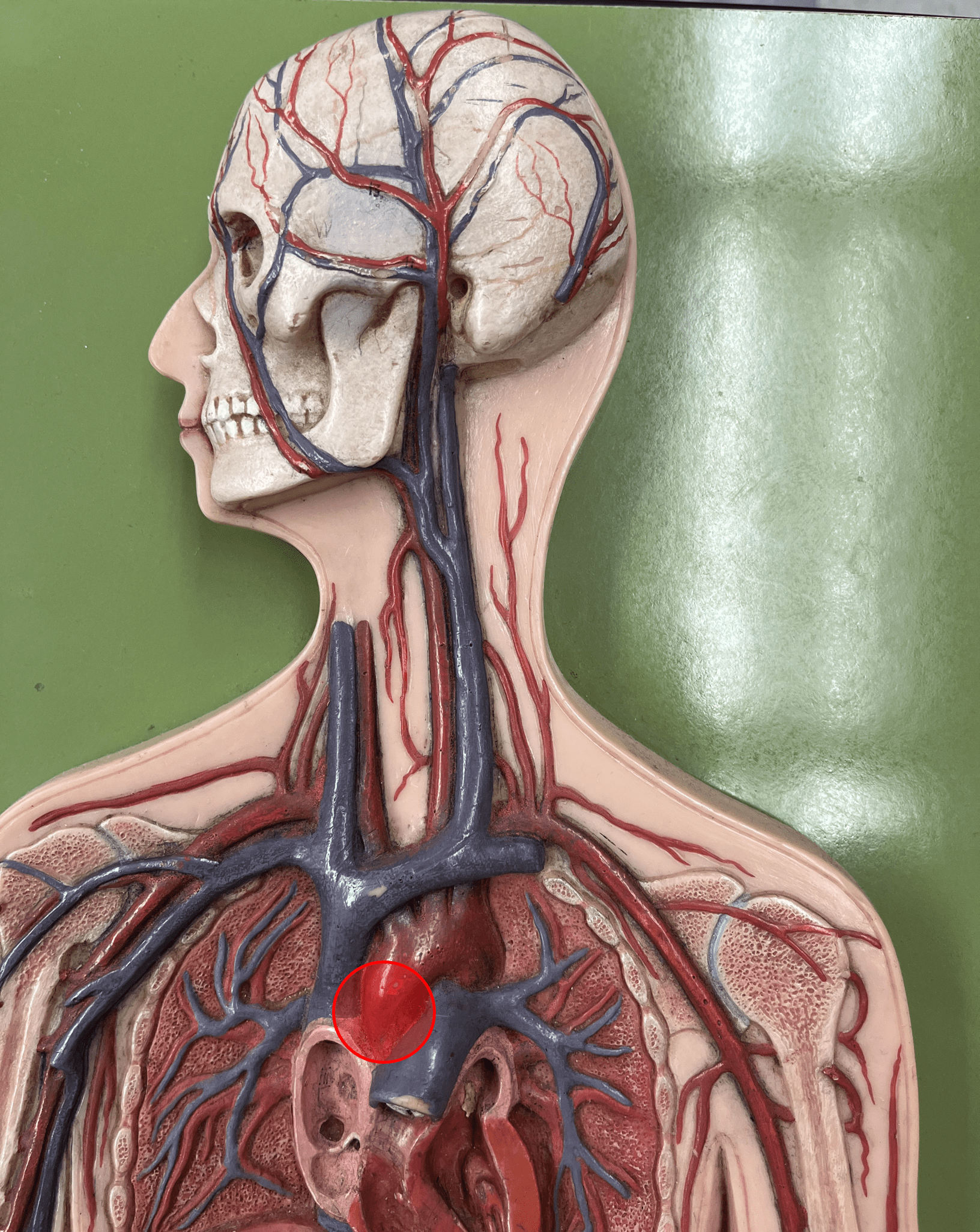 <p>• An artery of the thorax.</p>
<p>• Originates from the left ventricle of the heart.</p>
<p>• Supplies its branches.</p>