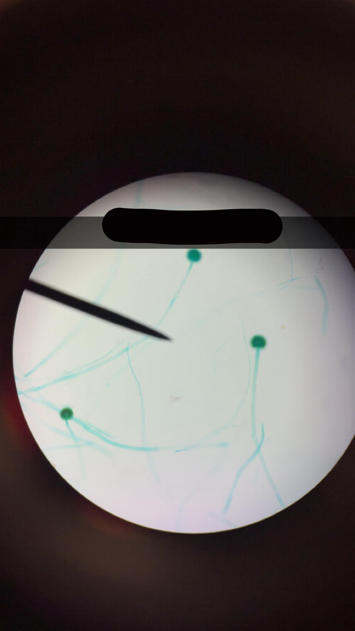 <p>What’s the name of this </p>