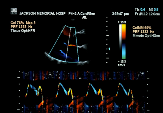 <p>what does this image display?</p>
