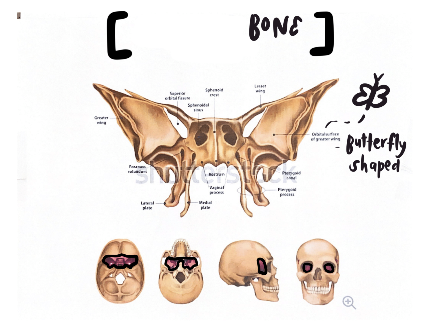 <p>what bone is this?</p>
