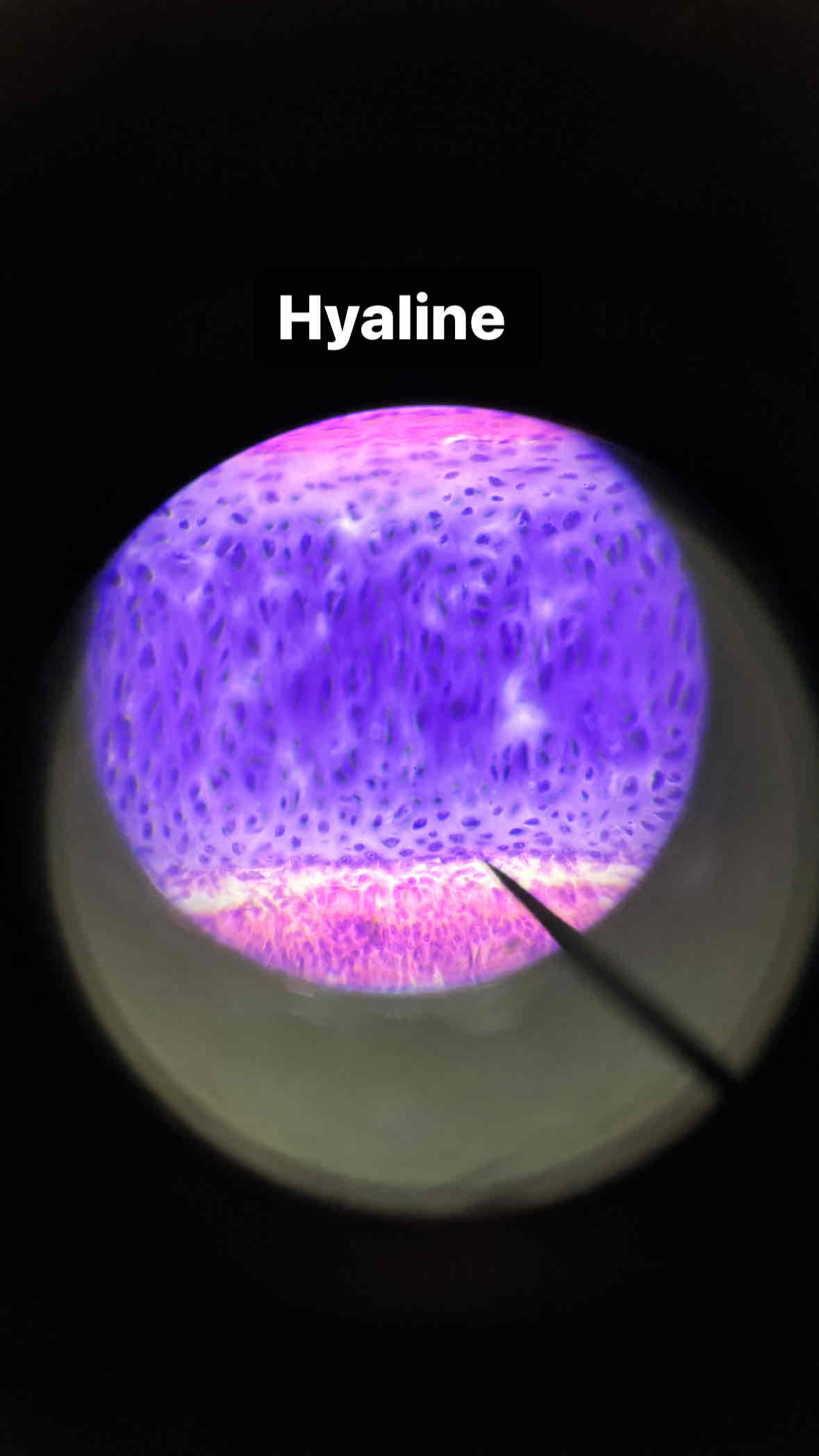 <p>type and subtype of tissue?</p>