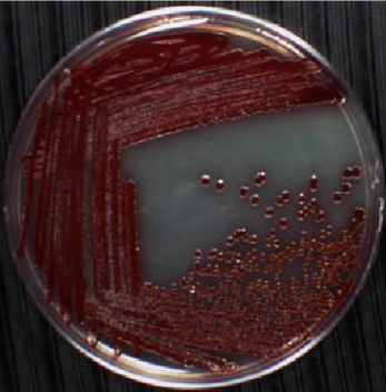 <p>Identify method of isolating pure culture of microorganisms.</p>