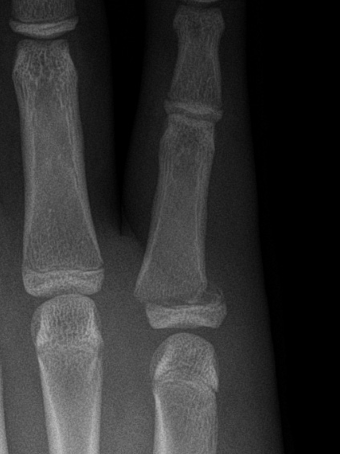 <p>Describe the abnormality demonstrated. </p>
