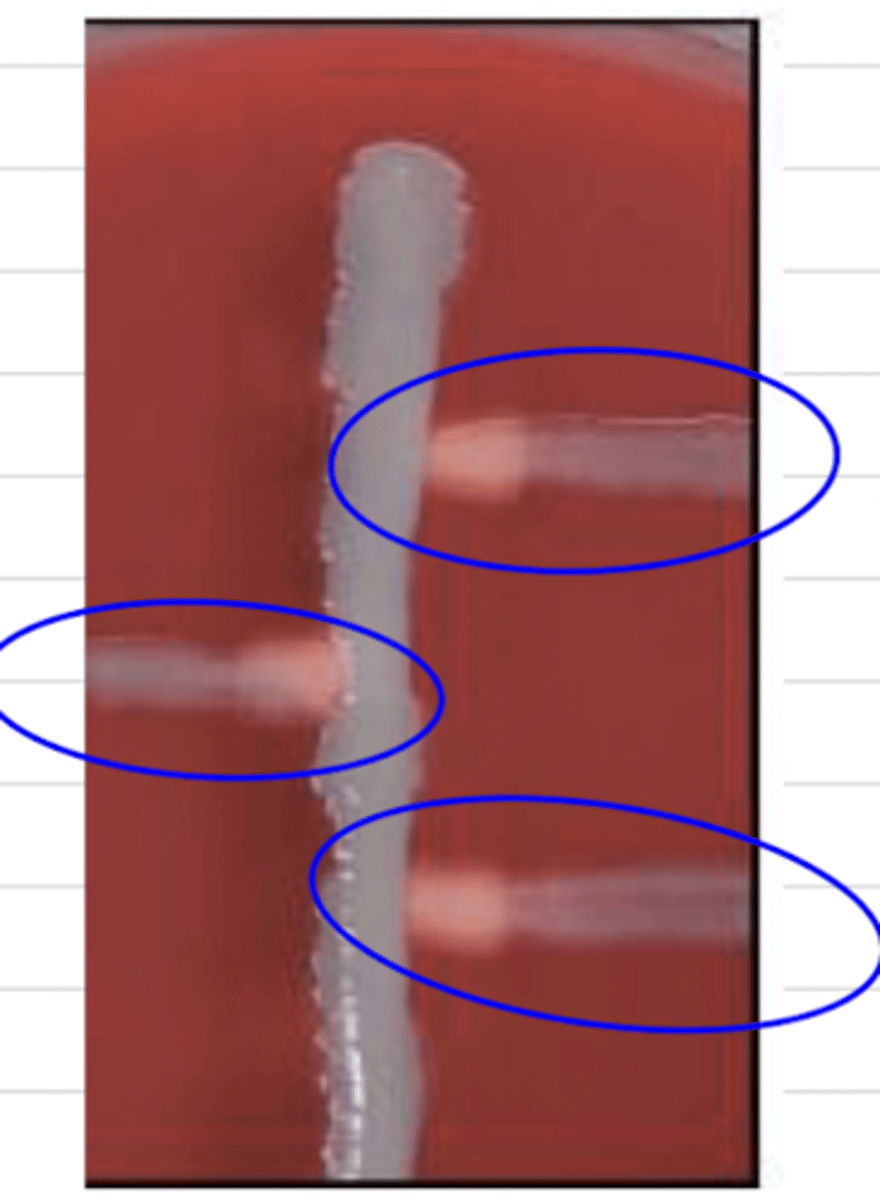 <p>when performing the CAMP test, the bacteria forms these shapes. what species is it?</p>