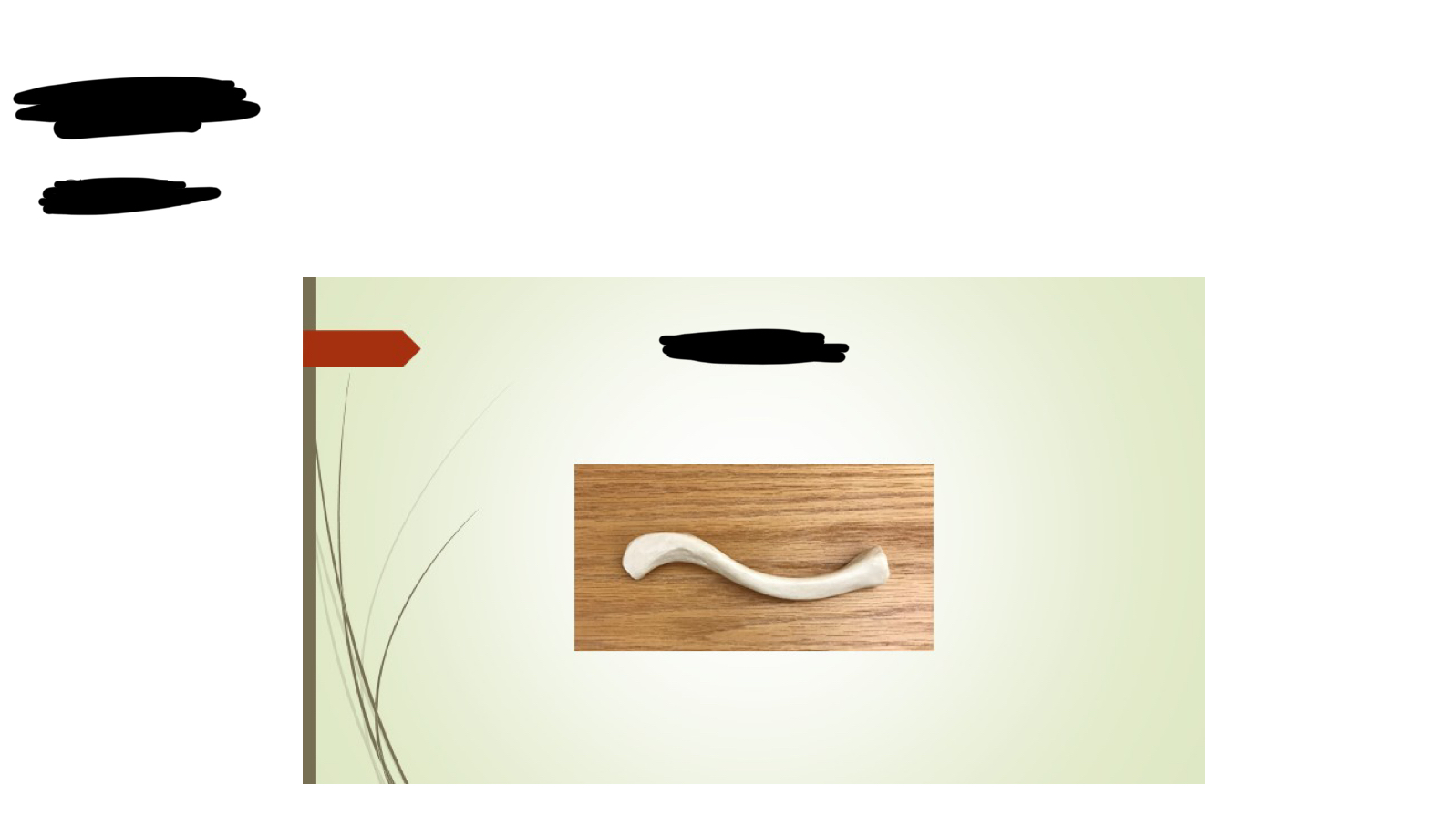 <p>Clavicle </p>