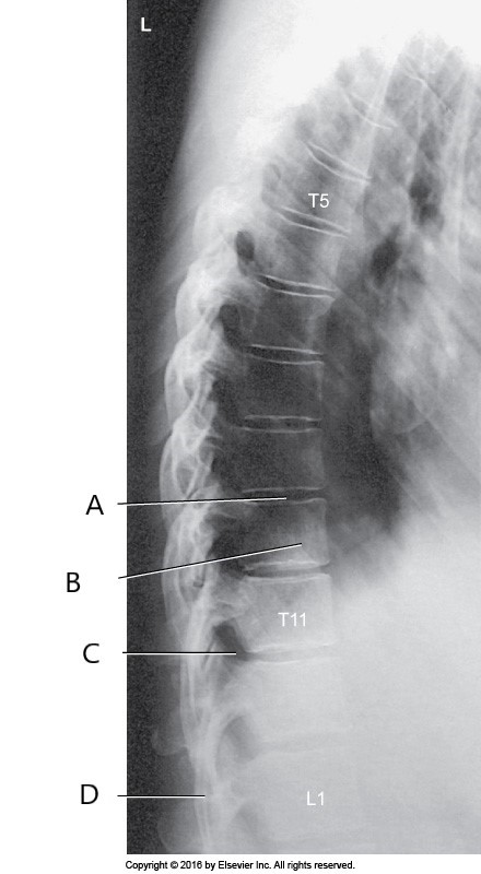 <p>letter C represents?</p>