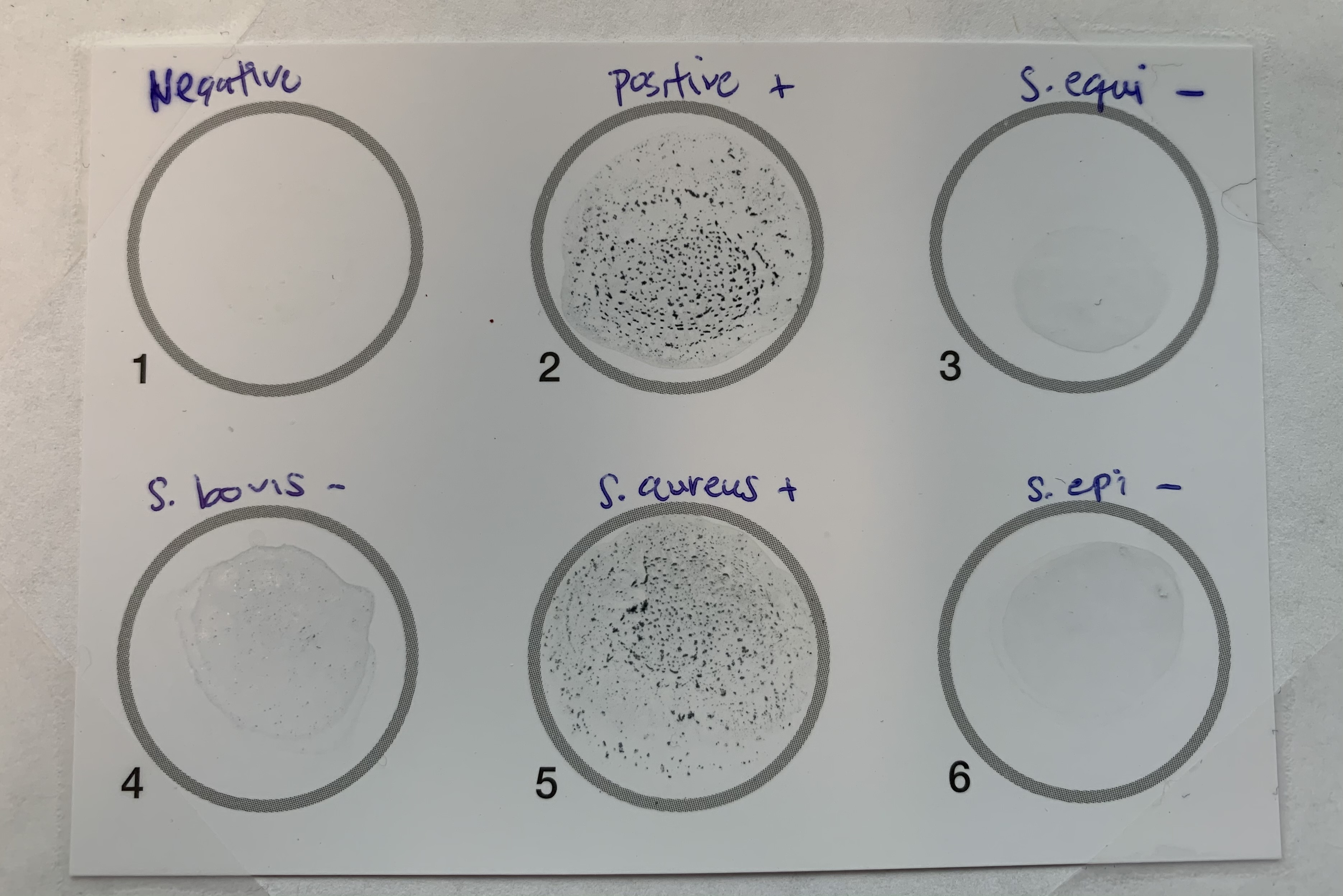 <p>This is a Latex Agglutination Test, what does this indicate?</p>