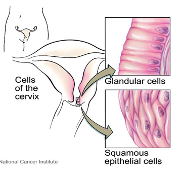 <p>Papanicolaou Exam</p><ul><li><p>Purpose: Evaluates condition of the cervical cells; </p><ul><li><p>important for early detection of premalignant lesions and cervical cancer</p></li></ul></li></ul><ul><li><p>Minimum of two samples taken:</p><ul><li><p>Ectocervical specimen</p></li><li><p>Endocervical specimen</p></li></ul></li></ul><p></p><p></p>