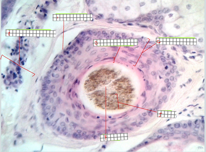 <p>specimen<br>type of section:<br>label</p>