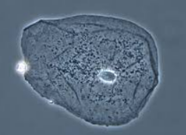 <p><span style="background-color: transparent;"><span>Phase-Contrast is used to see …</span></span></p>