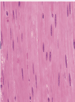 <ul><li><p><span style="background-color: transparent; font-family: "Book Antiqua", serif;"><span>Involuntary</span></span></p></li><li><p><span style="background-color: transparent; font-family: "Book Antiqua", serif;"><span>Lacks striations</span></span></p></li><li><p><span style="background-color: transparent; font-family: "Book Antiqua", serif;"><span>Controlled by autonomic nervous system (involuntary)</span></span></p></li><li><p><span style="background-color: transparent; font-family: "Book Antiqua", serif;"><span>Oval shaped cells</span></span></p></li><li><p><span style="background-color: transparent; font-family: "Book Antiqua", serif;"><span>One central nucleus</span></span></p></li><li><p><span style="background-color: transparent; font-family: "Book Antiqua", serif;"><span>Found in GI tract and blood vessels</span></span></p></li></ul><p></p>