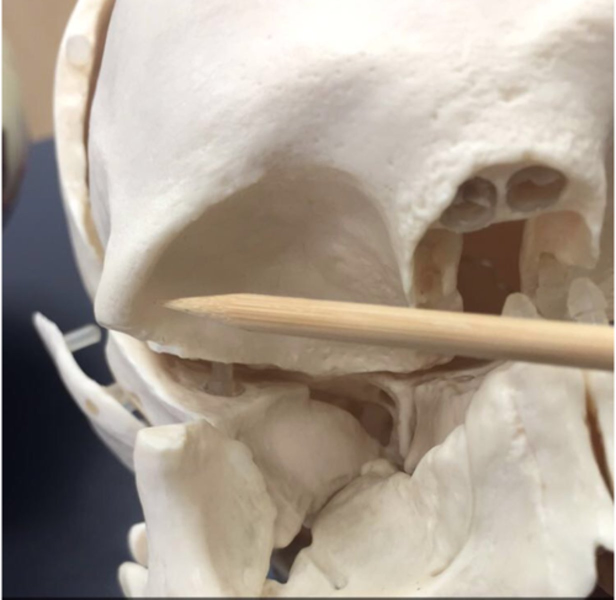 knowt flashcard image