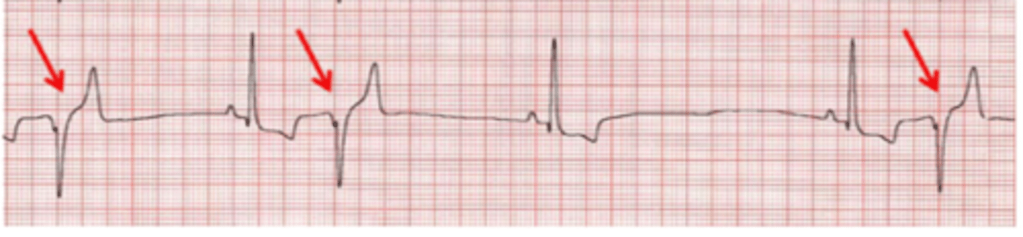 <p>Describe EKG</p>