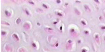 <p>fetal, articular respiratory, costal rib</p>