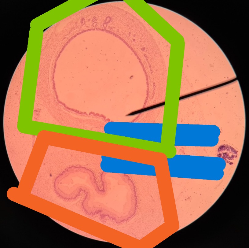 <p>Orange structure (organ)?</p><p>Structure found in submucosa?</p>