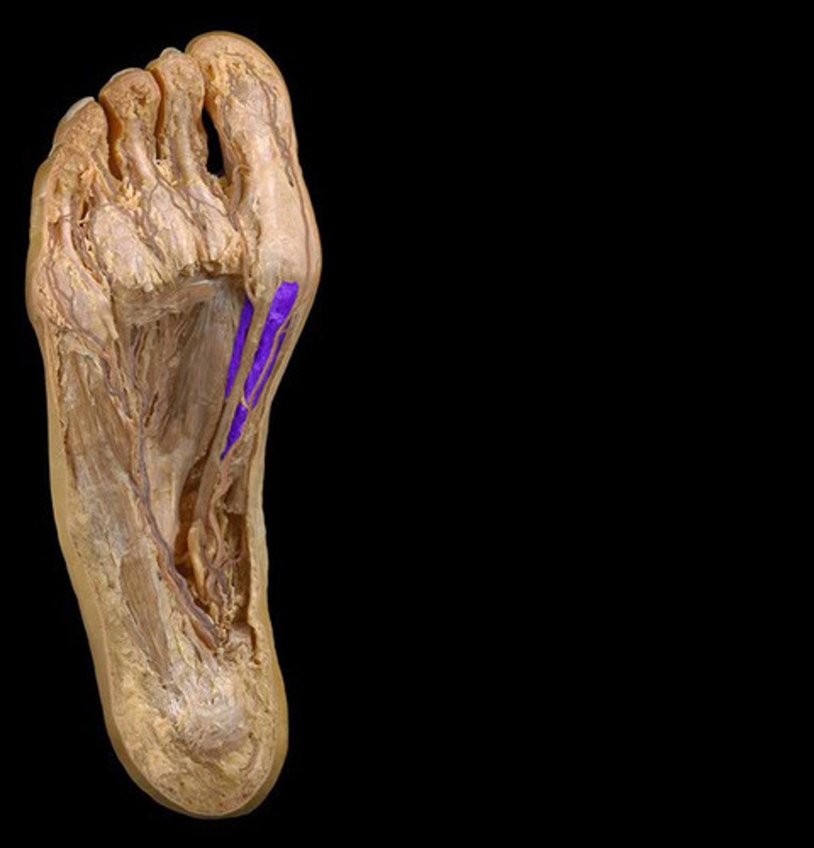 <p>Origin: Cuboid, lateral cuneiforms</p><p>Insertion: Both sides of the base of great toe proximal phalanx</p>